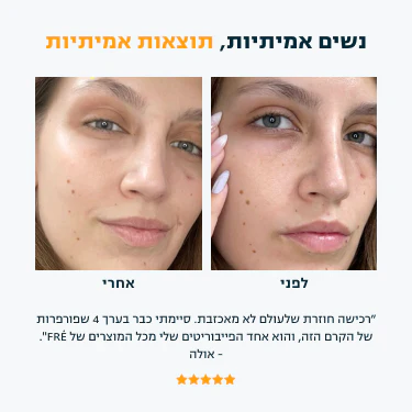 תמונת מוצר 4
